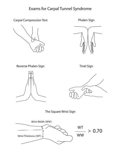 metacarpal compression test|carpal tunnel syndrome hand test.